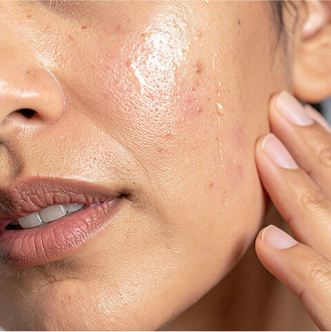 image-body-10